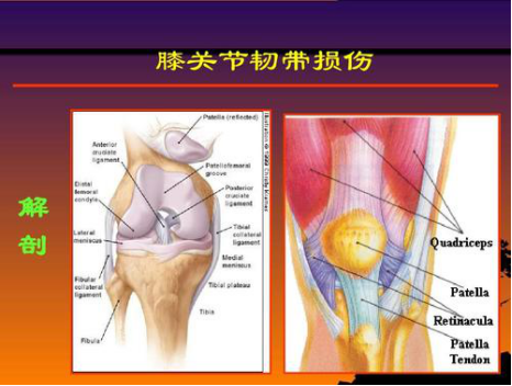 預防骨質(zhì)增生需注意哪些？(圖5)