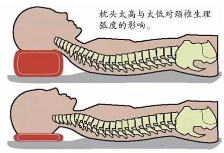 終于知道為(wèi)什麽睡醒後脖子酸痛！(圖2)